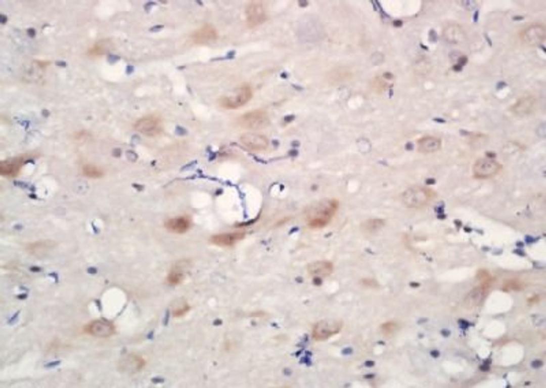 Immunohistochemical analysis of formalin-fixed paraffin embedded rat brain tissue using CHRNA6 antibody (dilution at 1:200)