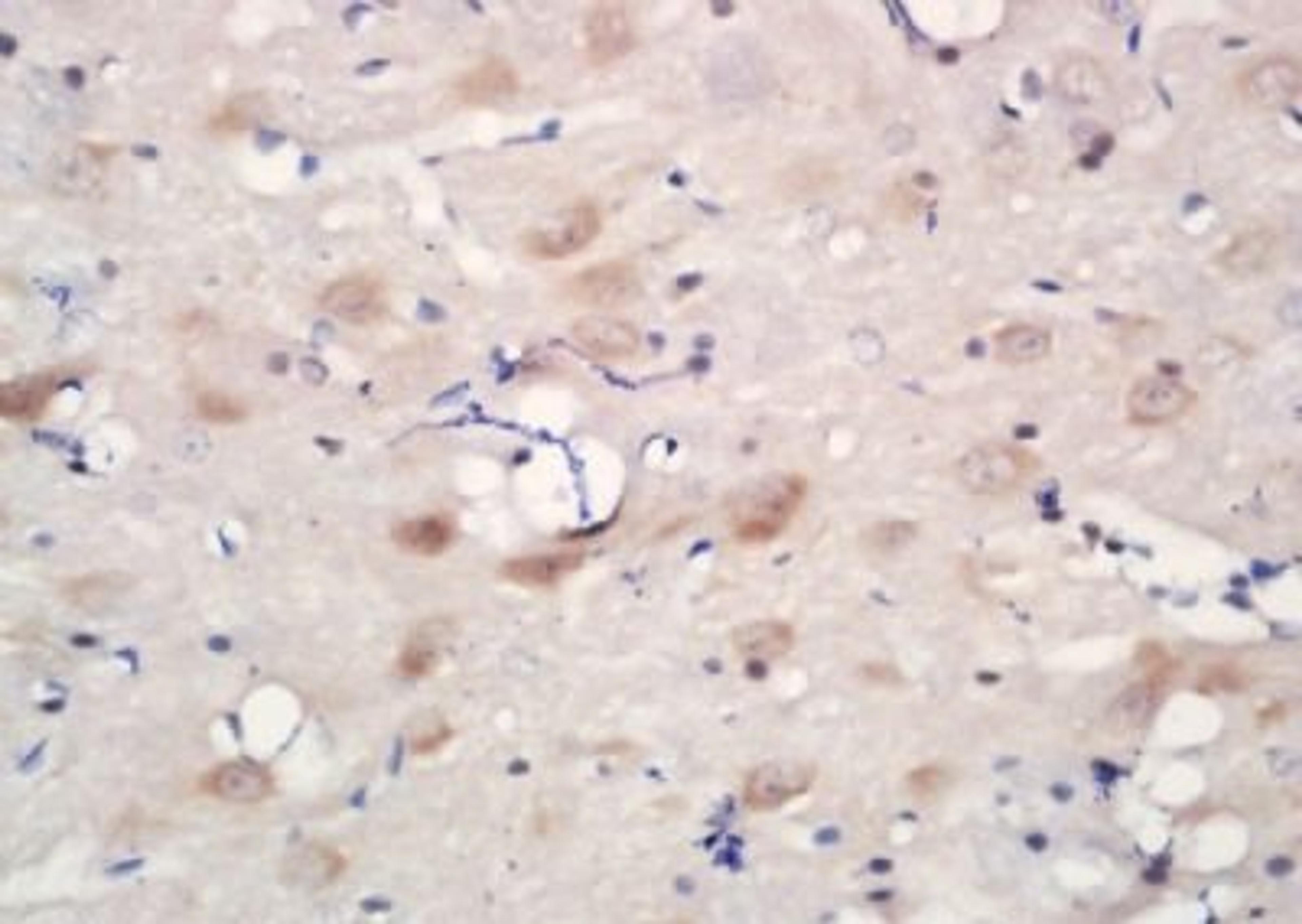 Immunohistochemical analysis of formalin-fixed paraffin embedded rat brain tissue using CHRNA6 antibody (dilution at 1:200)