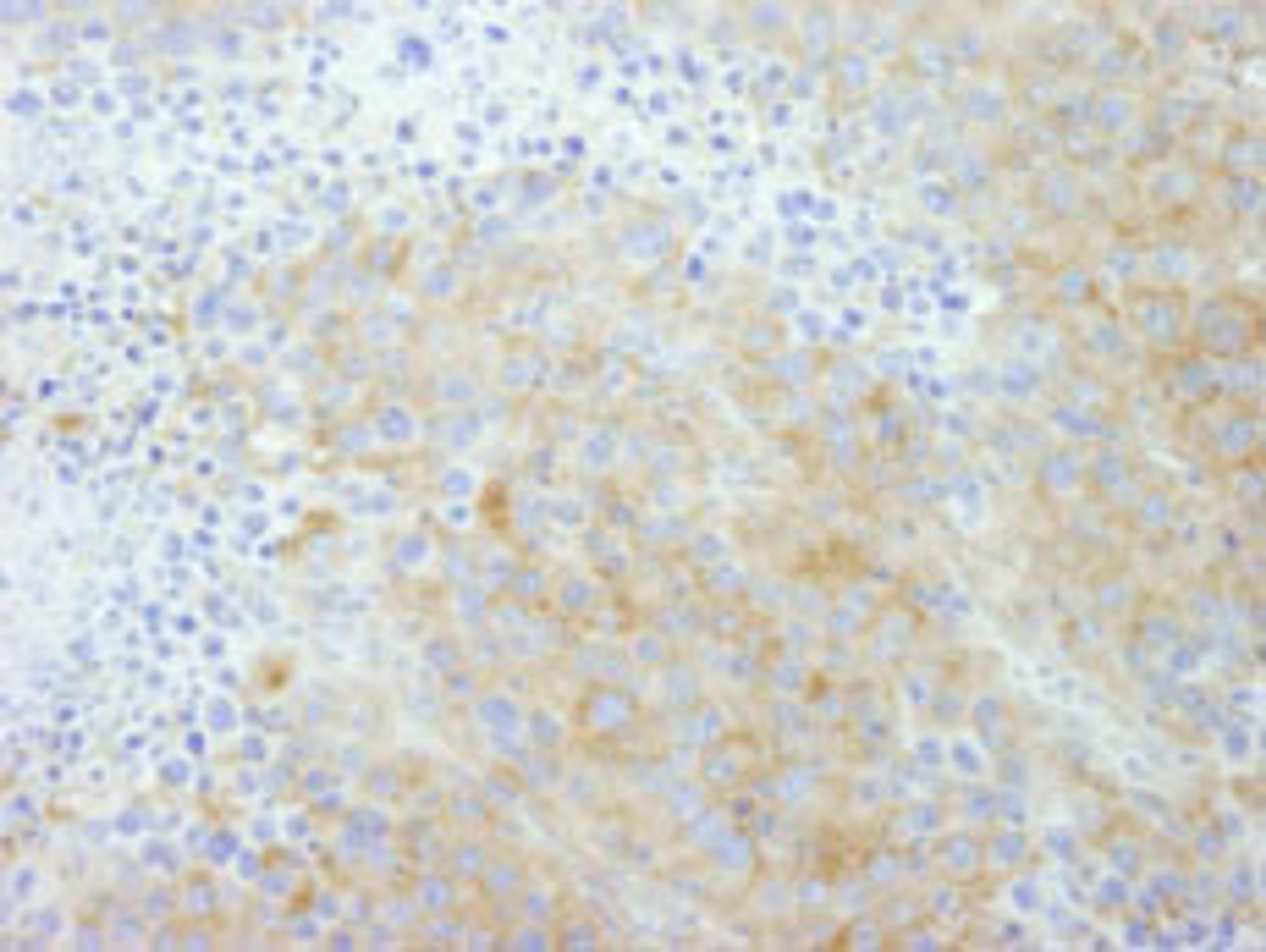 Detection of mouse PTPN12 by immunohistochemistry.