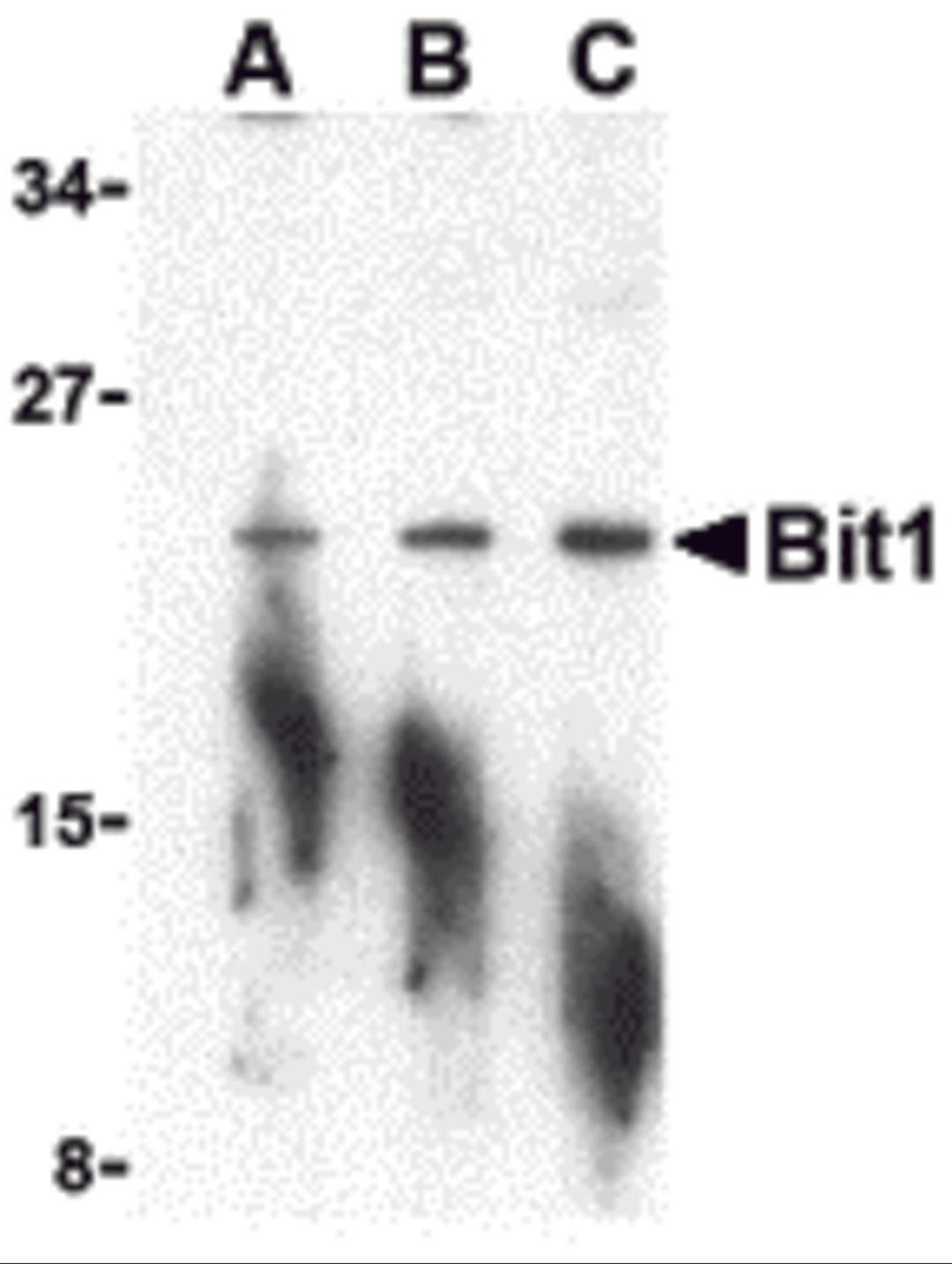 Western blot analysis of Bit1 in A-20 cell lysate with Bit1 antibody at (A) 1, (B) 2, and (C) 4 μg/mL.