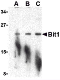 Western blot analysis of Bit1 in A-20 cell lysate with Bit1 antibody at (A) 1, (B) 2, and (C) 4 μg/mL.