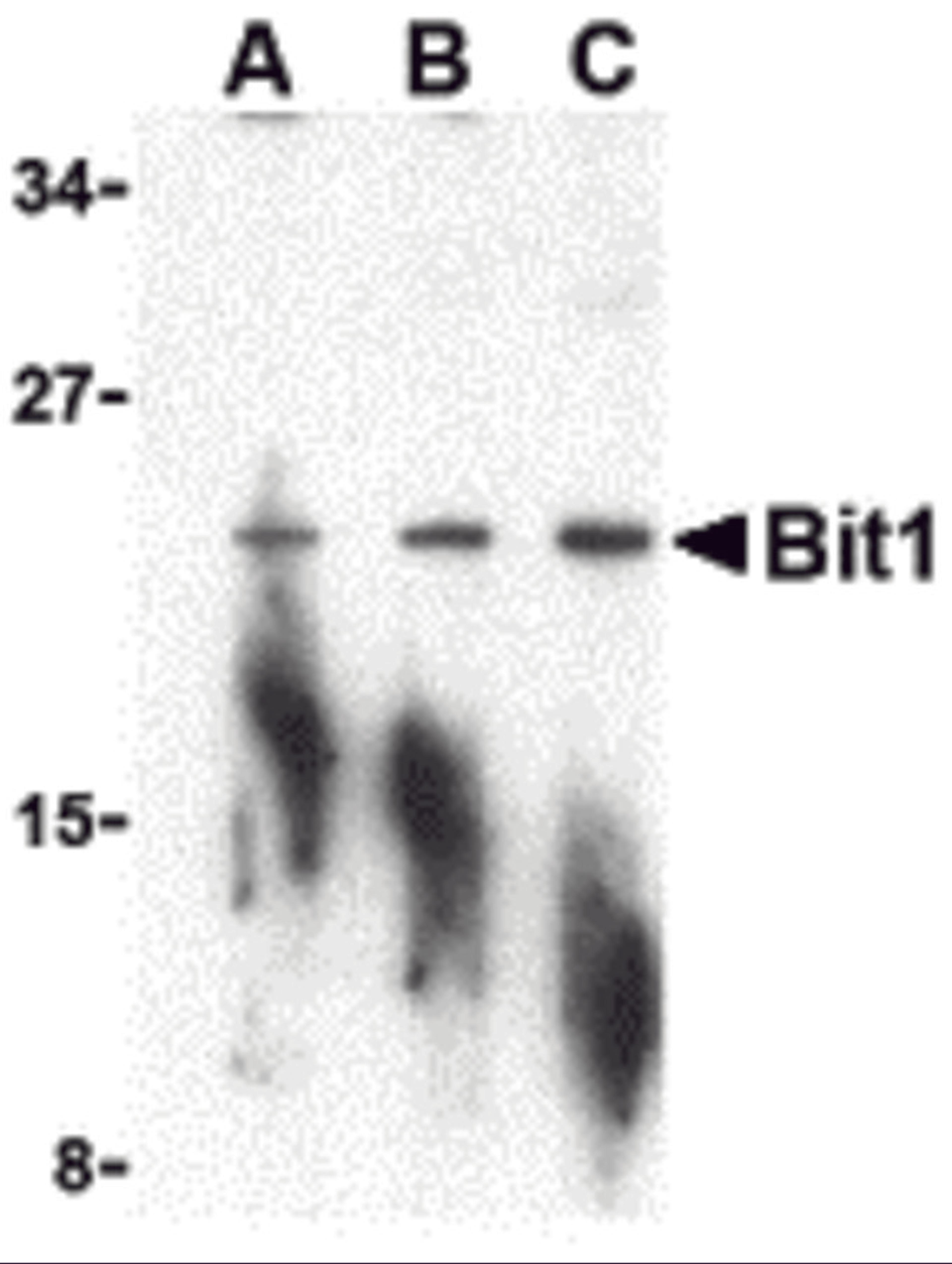 Western blot analysis of Bit1 in A-20 cell lysate with Bit1 antibody at (A) 1, (B) 2, and (C) 4 μg/mL.