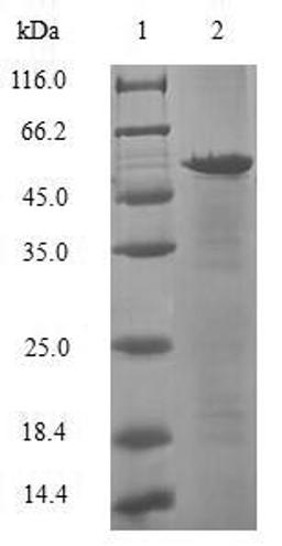 (Tris-Glycine gel) Discontinuous SDS-PAGE (reduced) with 5% enrichment gel and 15% separation gel.