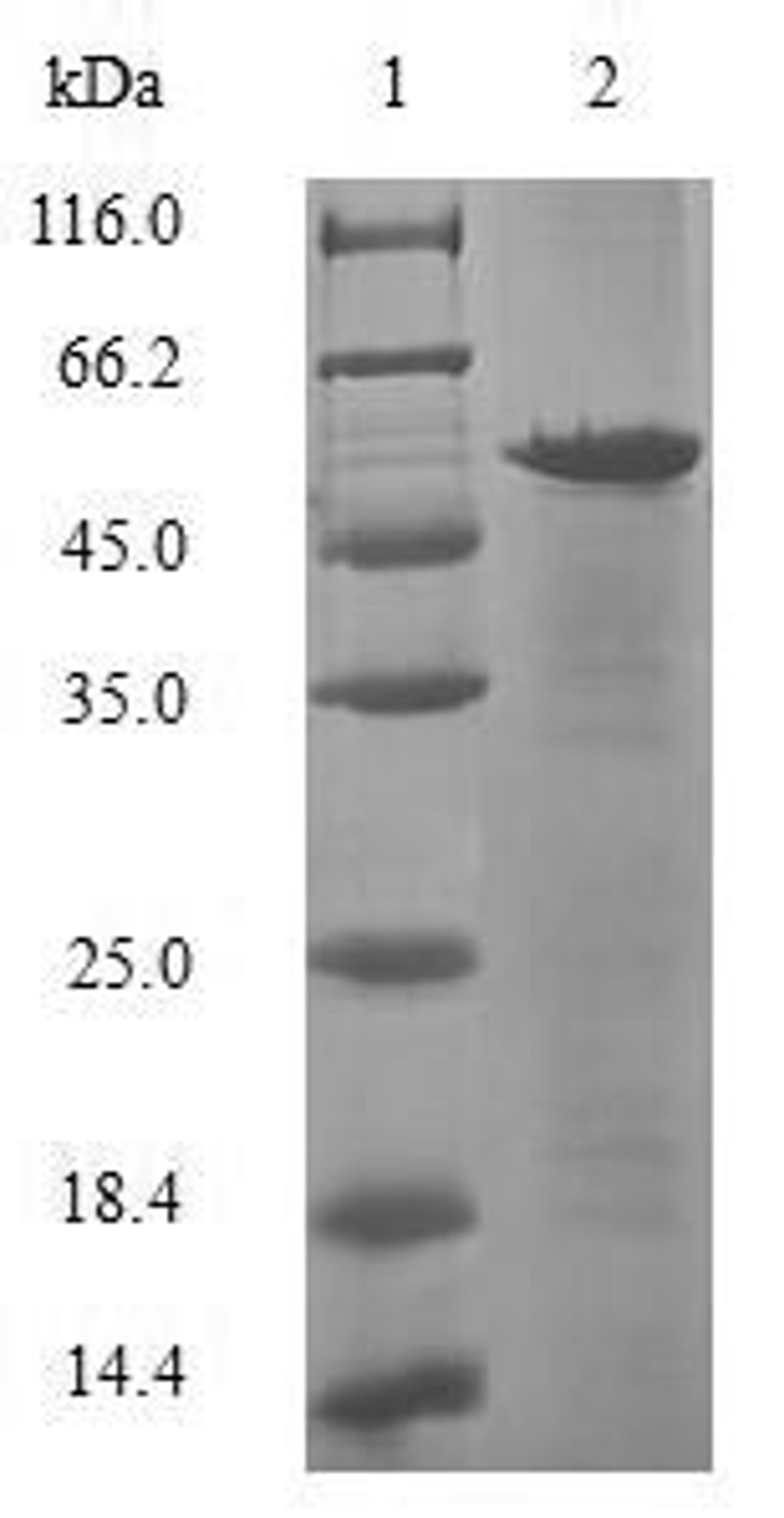 (Tris-Glycine gel) Discontinuous SDS-PAGE (reduced) with 5% enrichment gel and 15% separation gel.