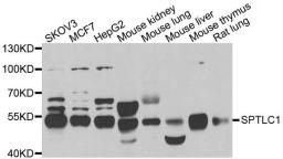 Western blot analysis of extracts of various cell lines using SPTLC1 antibody