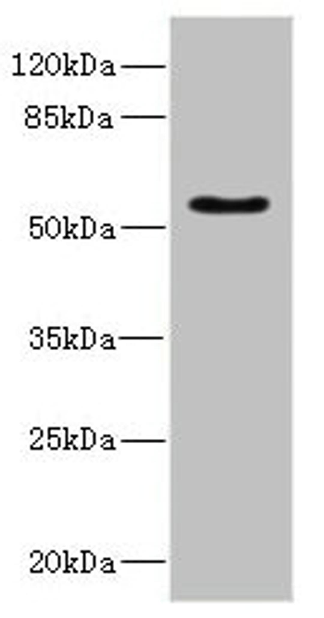 Western blot. All lanes: CALCRantibody IgG at 5.24ug/ml + Rat heart tissue. Secondary. Goat polyclonal to rabbit IgG at 1/10000 dilution. Predicted band size: 60, 56, 50, 52, 35, 33 kDa. Observed band size: 60 kDa. 