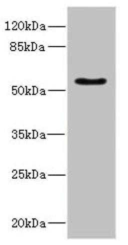 Western blot. All lanes: CALCRantibody IgG at 5.24ug/ml + Rat heart tissue. Secondary. Goat polyclonal to rabbit IgG at 1/10000 dilution. Predicted band size: 60, 56, 50, 52, 35, 33 kDa. Observed band size: 60 kDa. 