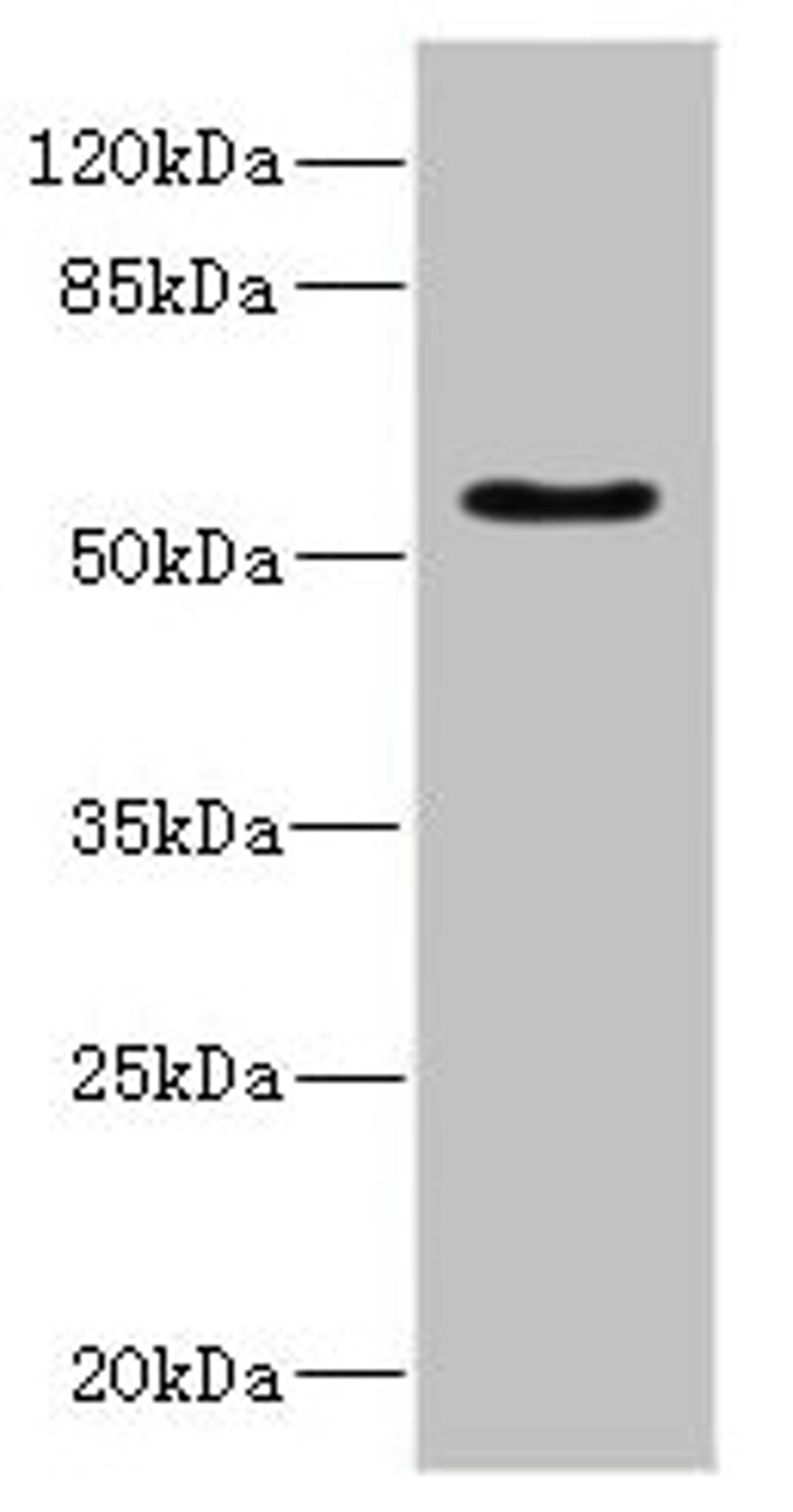 Western blot. All lanes: CALCRantibody IgG at 5.24ug/ml + Rat heart tissue. Secondary. Goat polyclonal to rabbit IgG at 1/10000 dilution. Predicted band size: 60, 56, 50, 52, 35, 33 kDa. Observed band size: 60 kDa. 