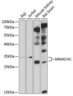 Western blot - MMACHC antibody (A10355)