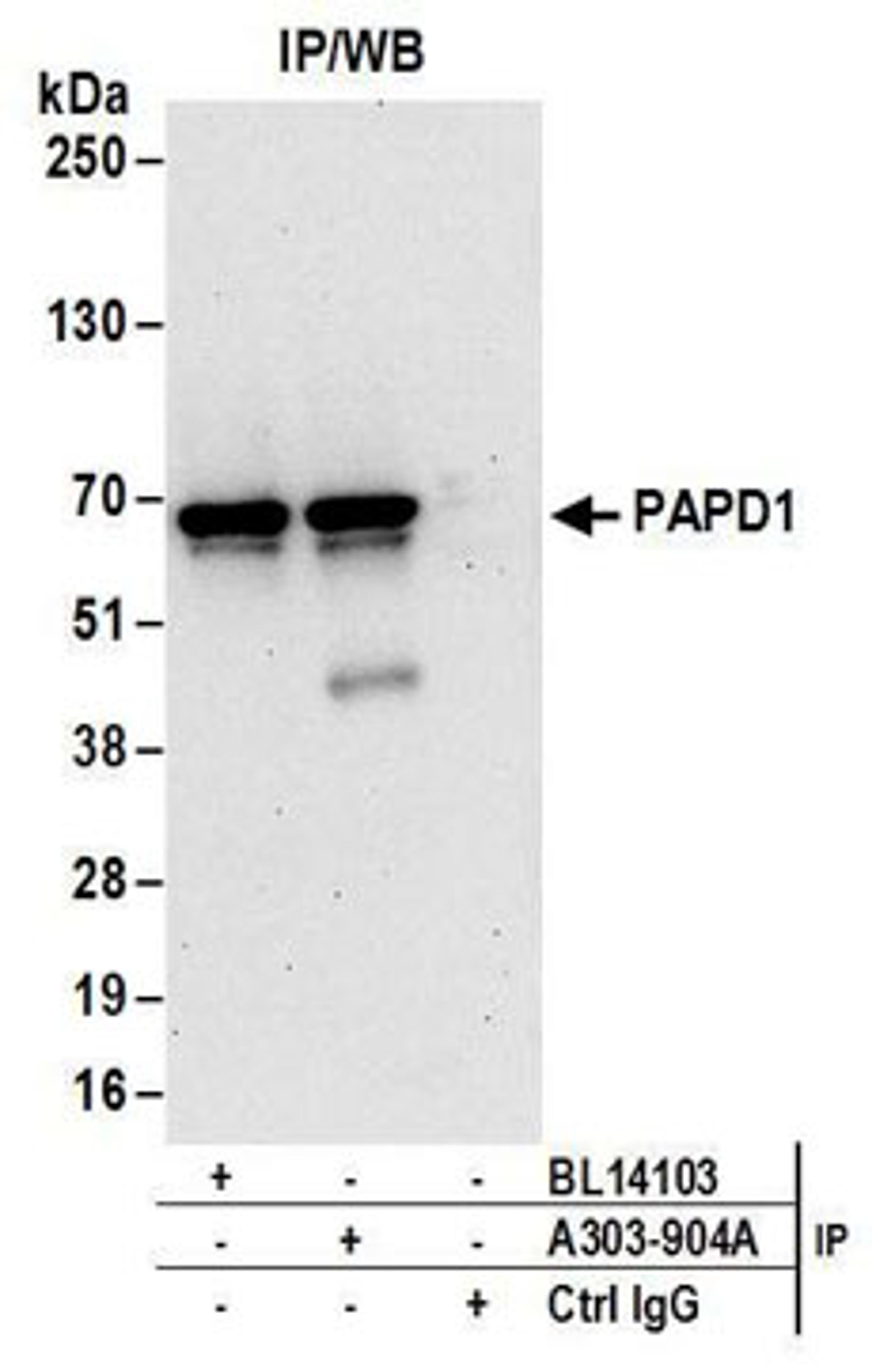 Detection of human PAPD1 by western blot of immunoprecipitates.