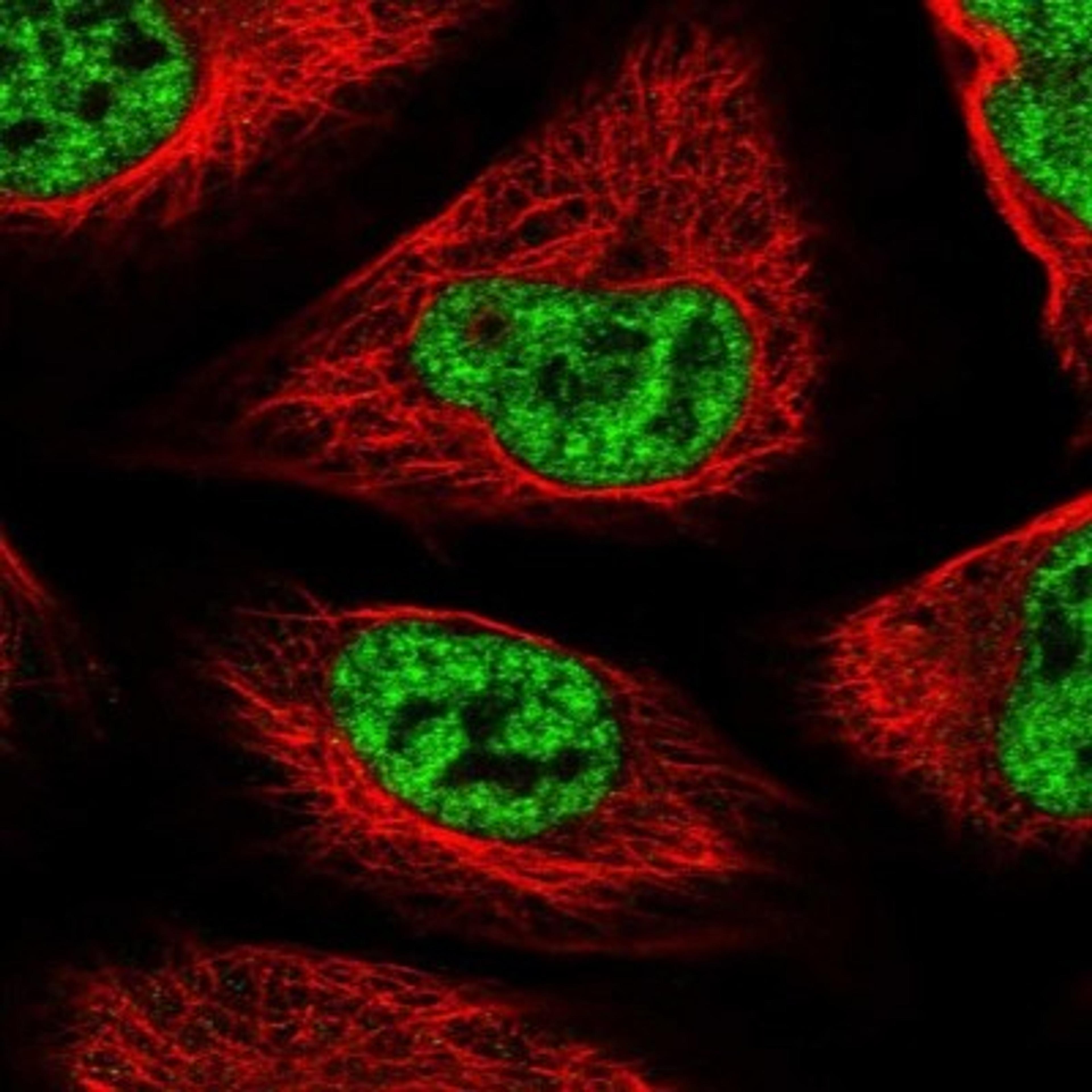 Immunocytochemistry/Immunofluorescence: SF3B14 Antibody [NBP1-87431] - Staining of human cell line U-2 OS shows positivity in nucleus but not nucleoli.