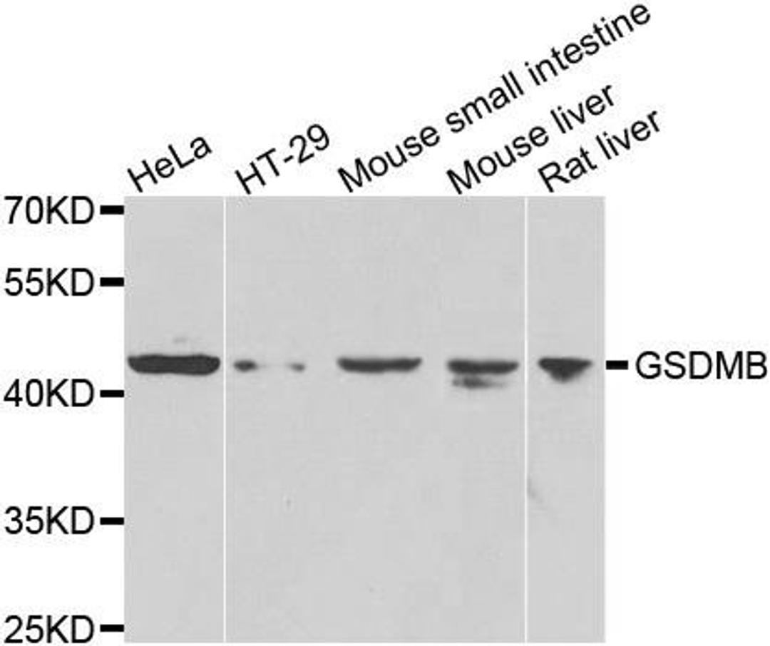 Western blot analysis of extracts of various cell lines using GSDMB antibody