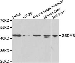 Western blot analysis of extracts of various cell lines using GSDMB antibody