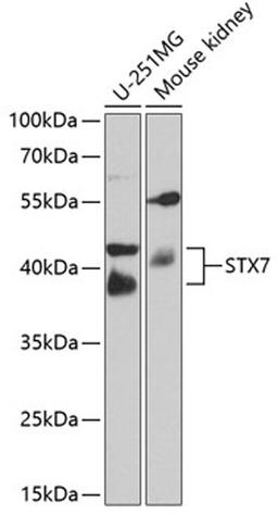 Western blot - STX7 antibody (A8057)