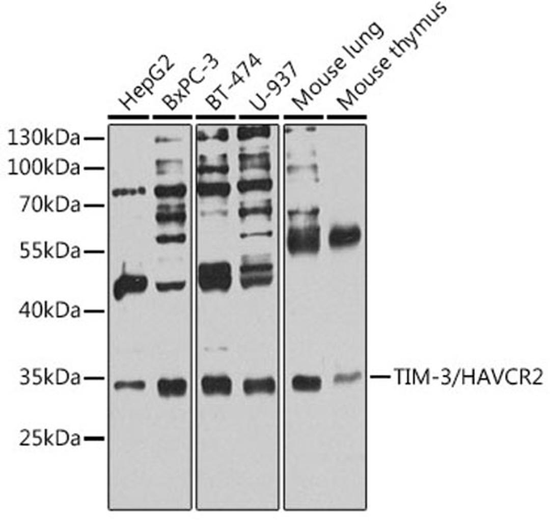 Western blot - TIM-3/HAVCR2 antibody (A2516)