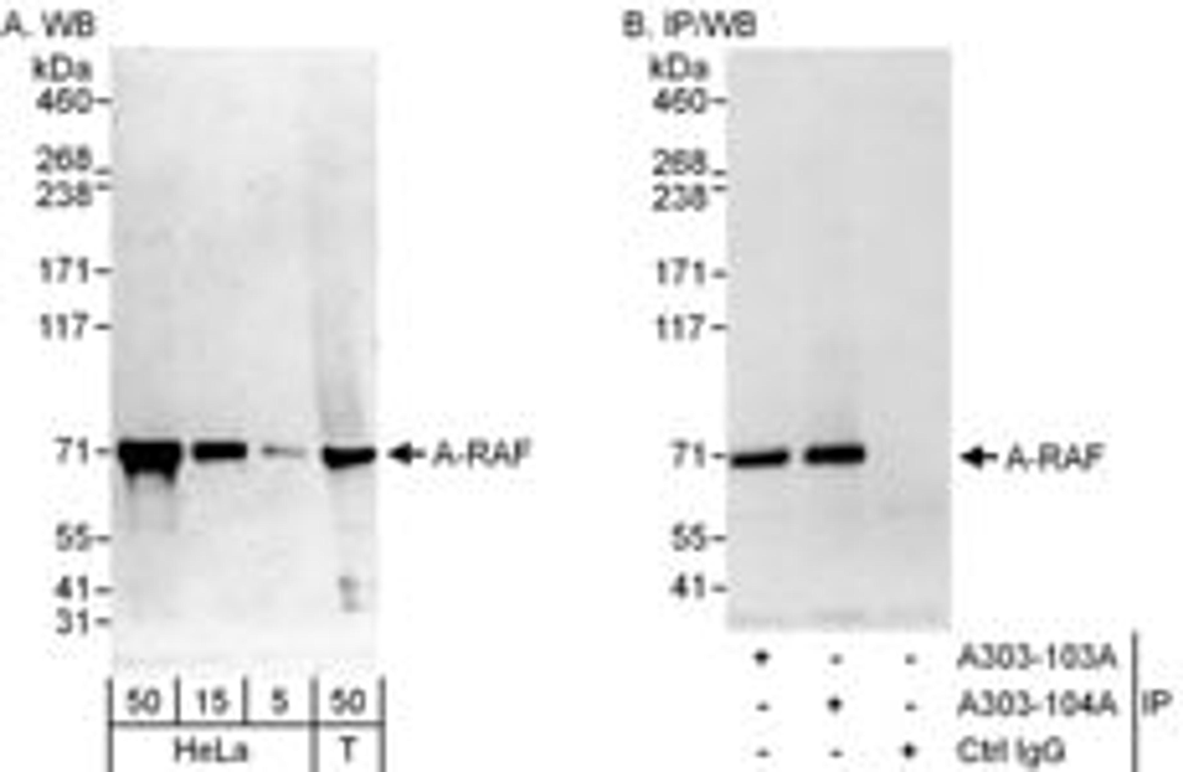 Detection of human A-RAF by western blot and immunoprecipitation.