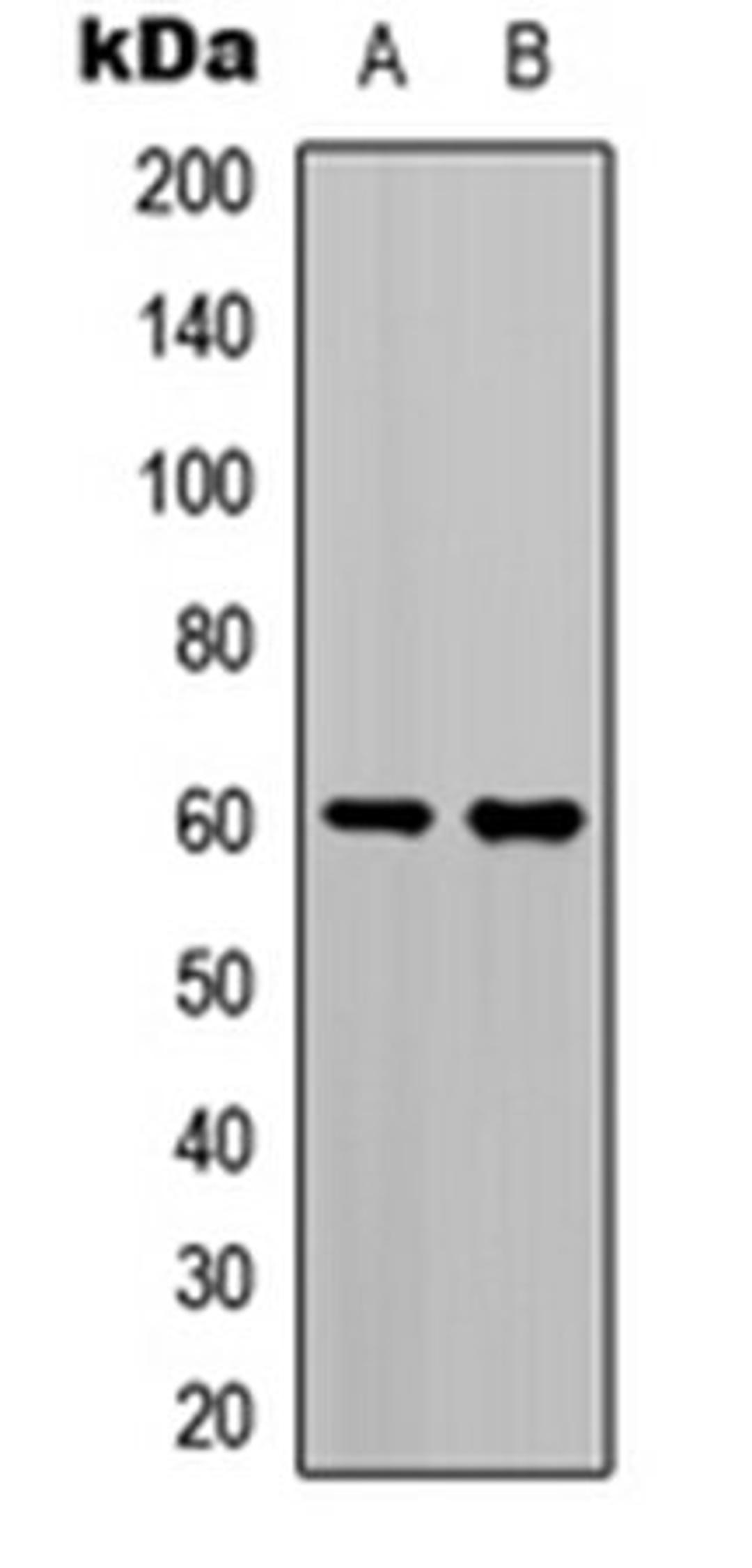 Western blot analysis of K562 (Lane 1), A549 (Lane 2) whole cell lysates using TCF4/12 antibody