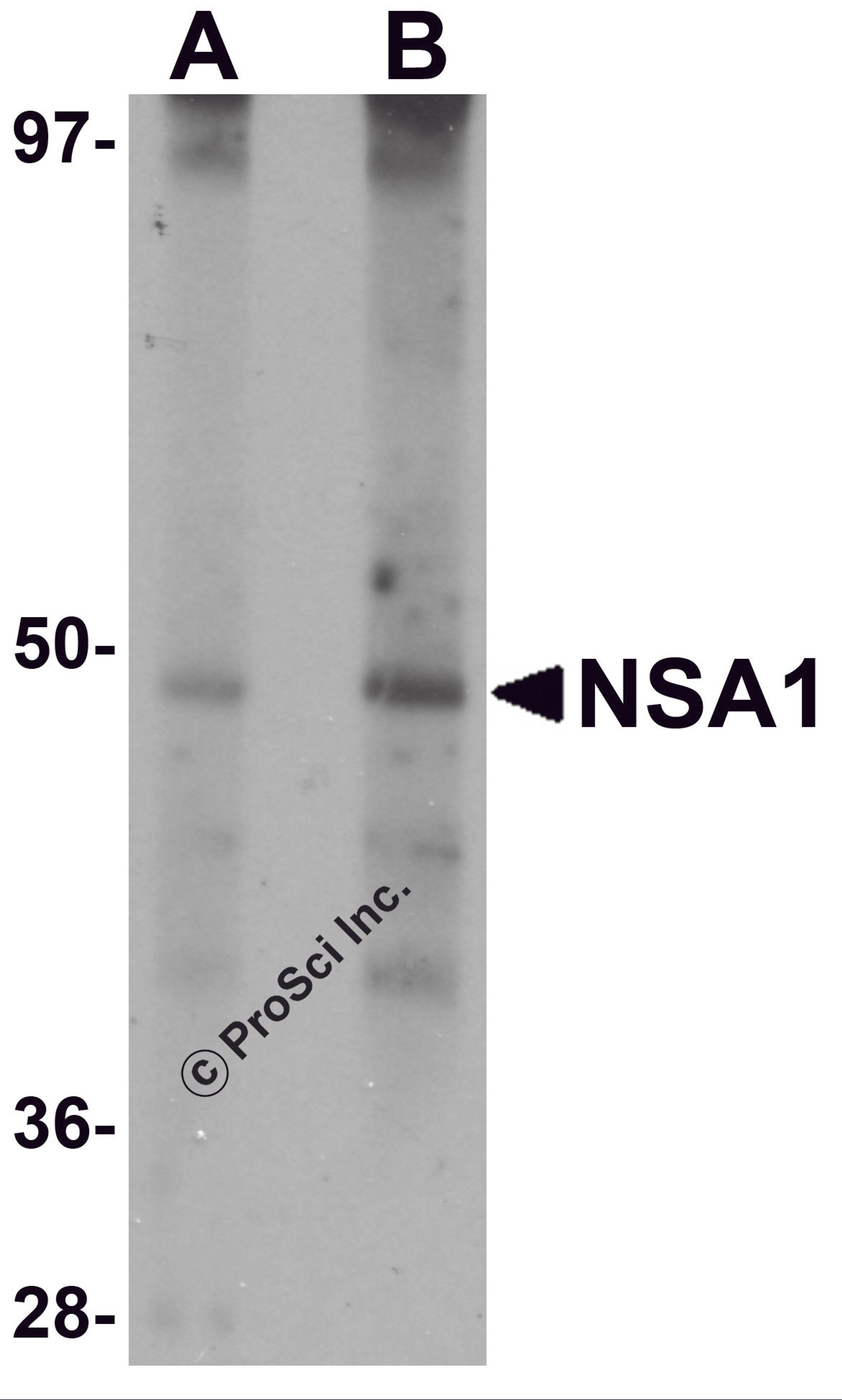 Western blot analysis of NSA1 in rat liver tissue lysate with NSA1 antibody at (A) 1 and (B) 2 &#956;g/mL.