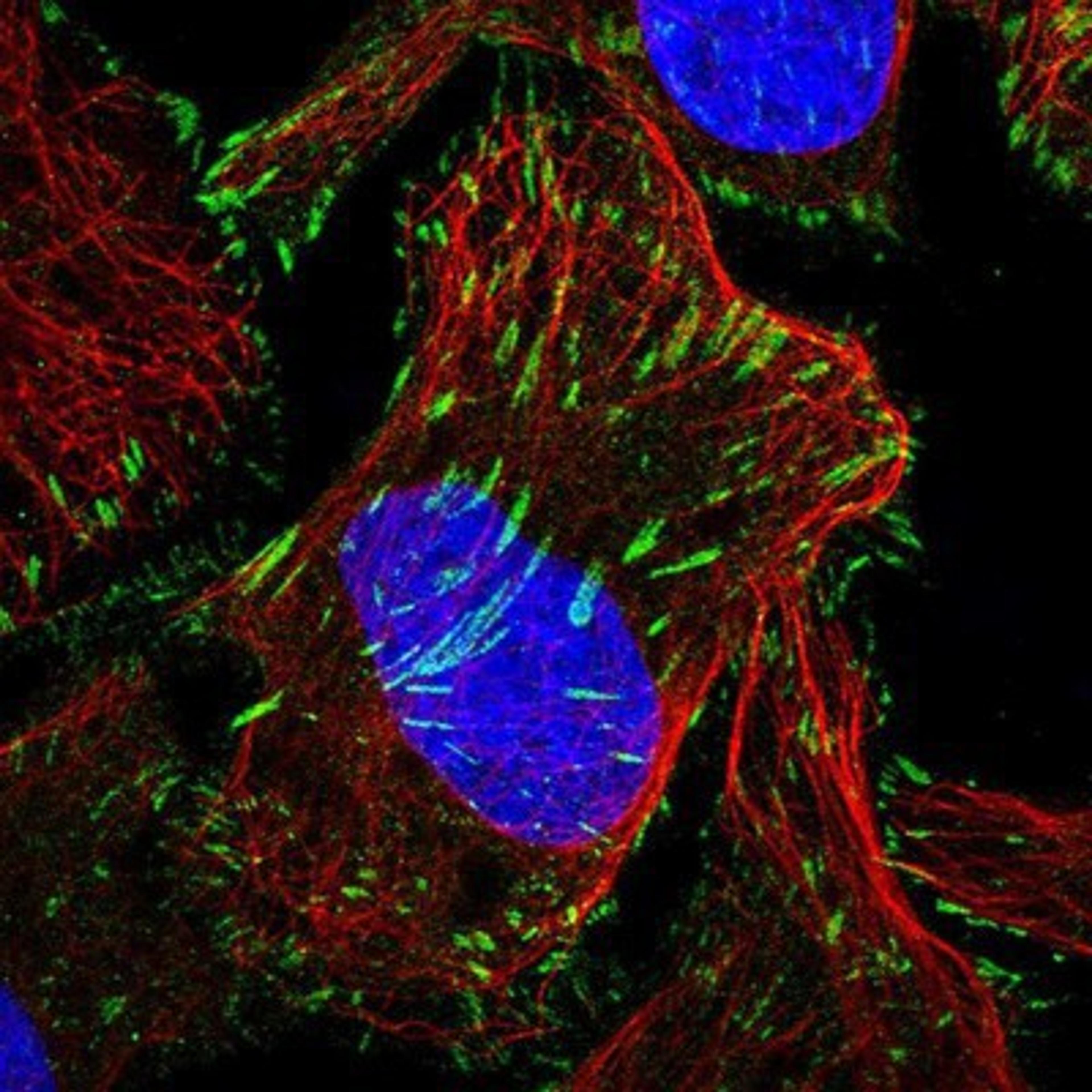 Immunocytochemistry/Immunofluorescence: Tensin 1 Antibody [NBP1-84129] Staining of human cell line U-2 OS shows positivity in focal adhesions.