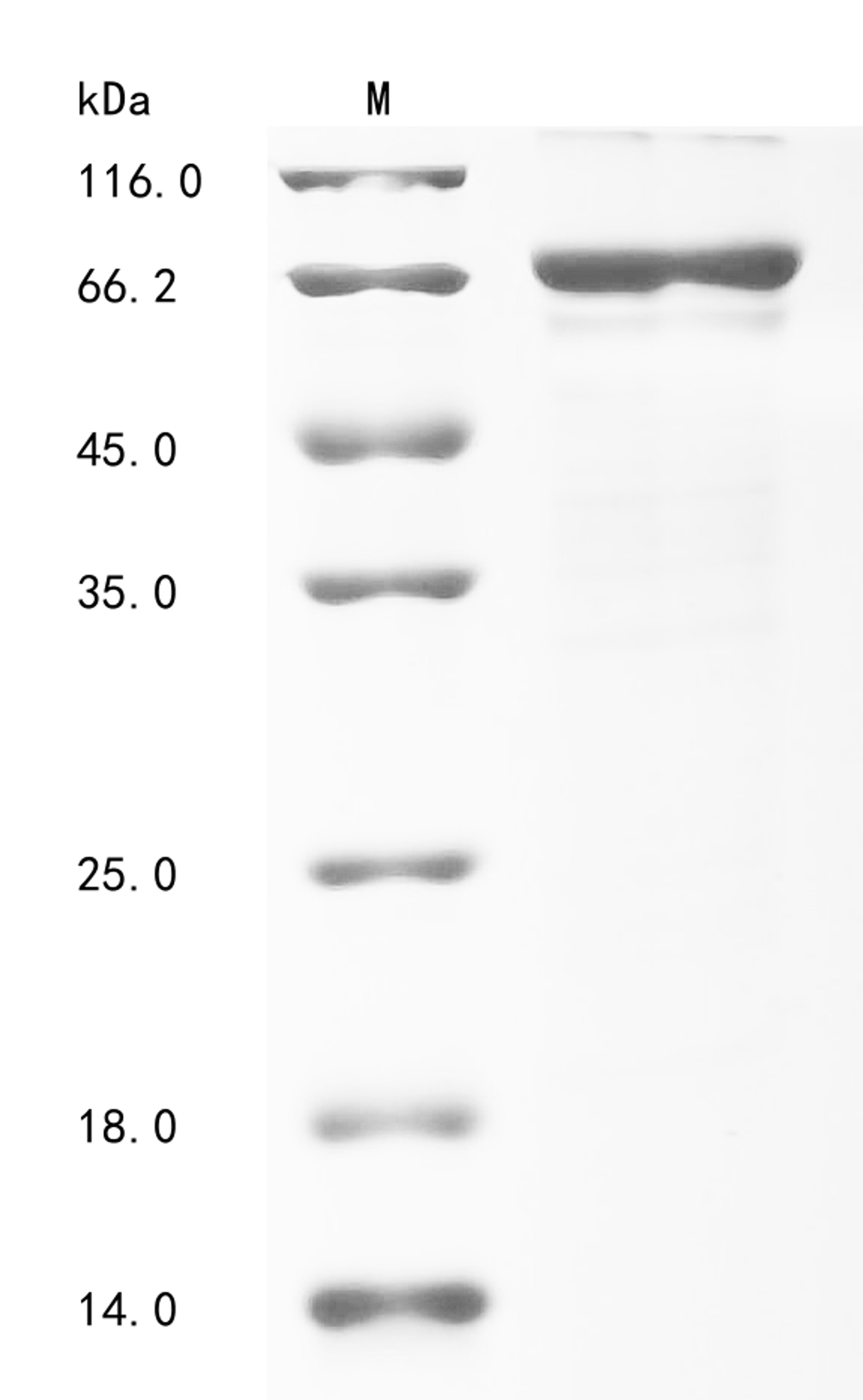 (Tris-Glycine gel) Discontinuous SDS-PAGE (reduced) with 5% enrichment gel and 15% separation gel.