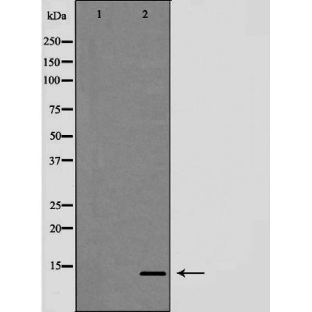 Western blot analysis of HeLa cells using Trefoil factor 2 (phospho-tFF2) antibody