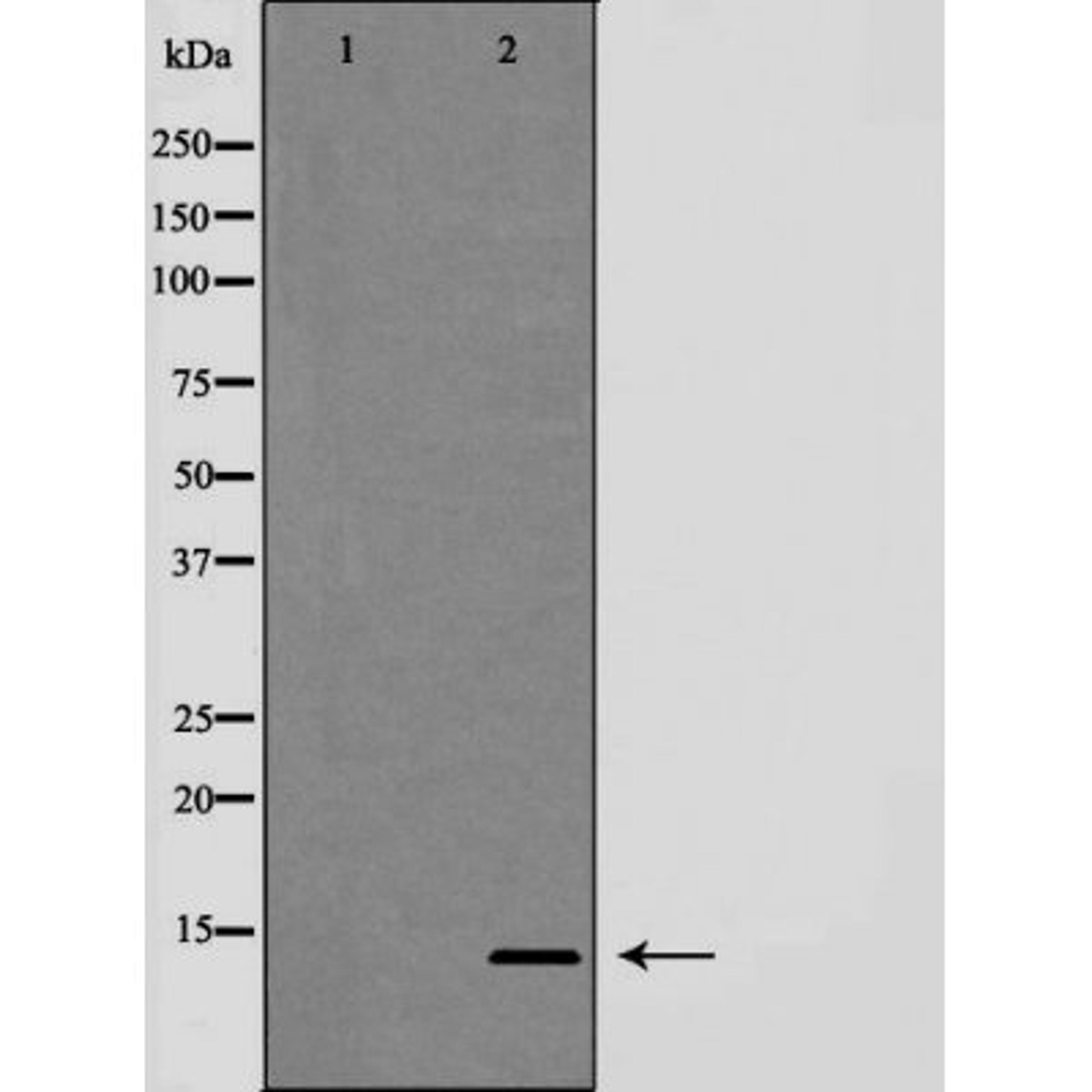 Western blot analysis of HeLa cells using Trefoil factor 2 (phospho-tFF2) antibody