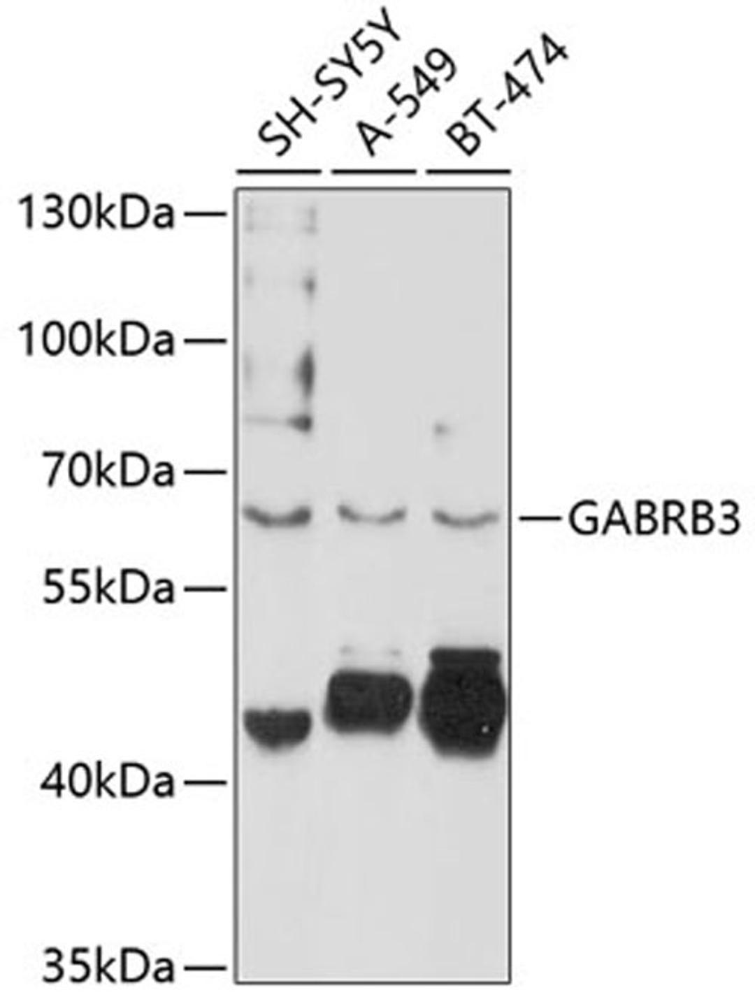 Western blot - GABRB3 antibody (A10015)