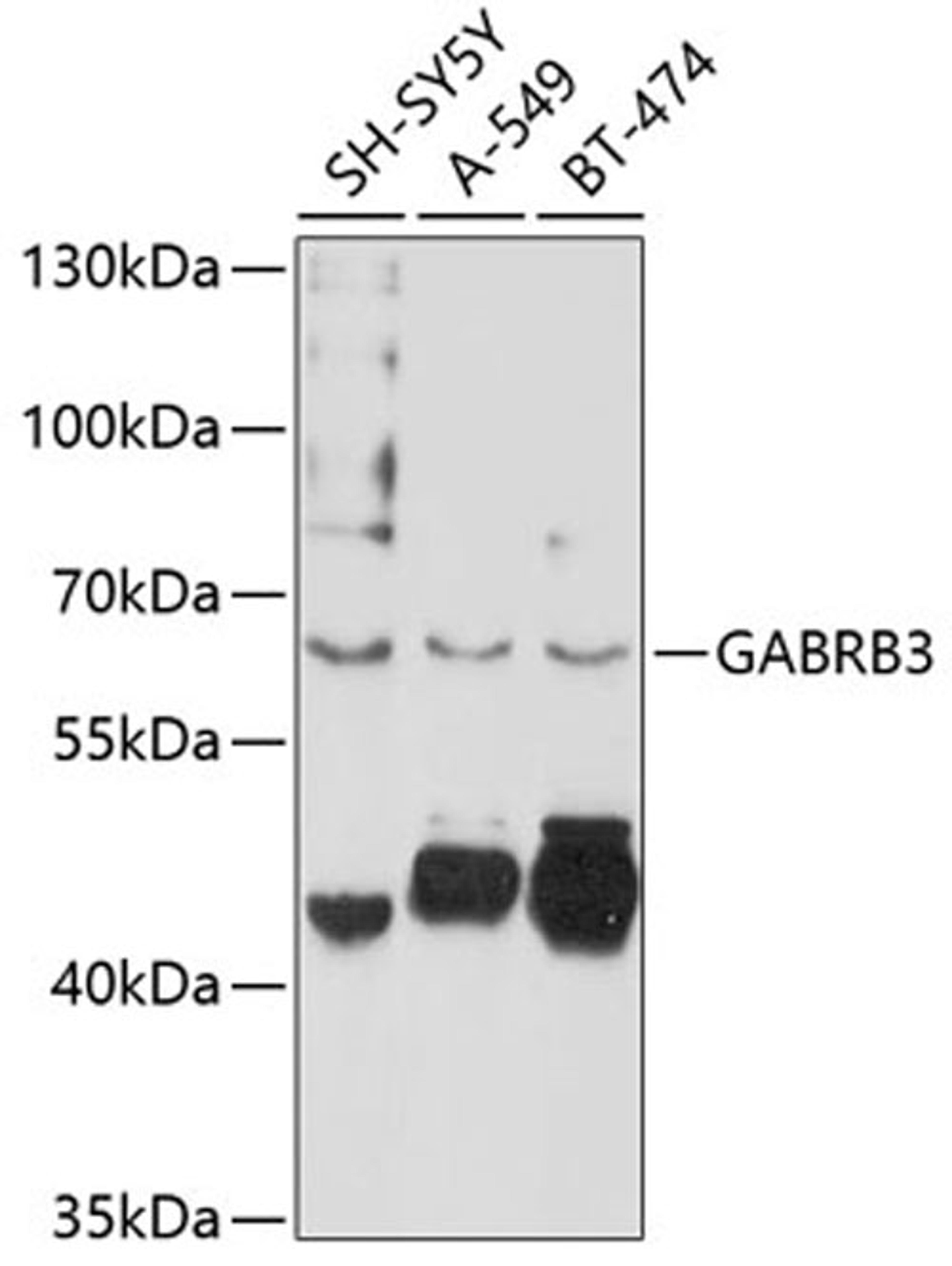 Western blot - GABRB3 antibody (A10015)