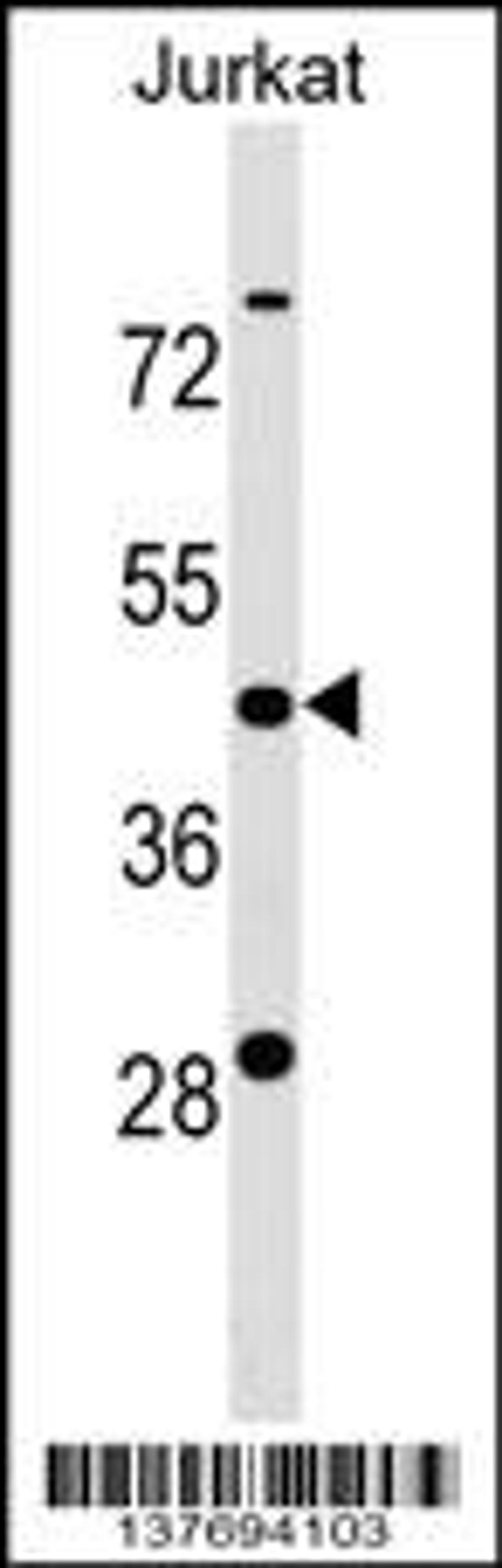 Western blot analysis in Jurkat cell line lysates (35ug/lane).