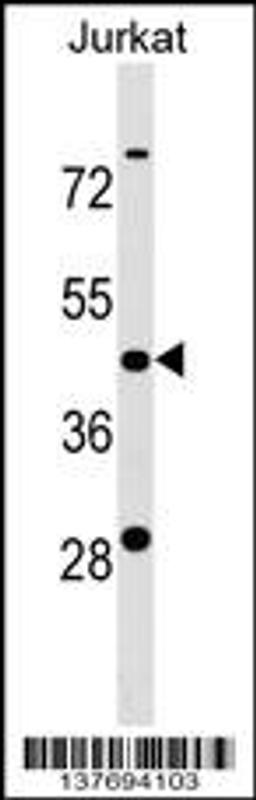 Western blot analysis in Jurkat cell line lysates (35ug/lane).