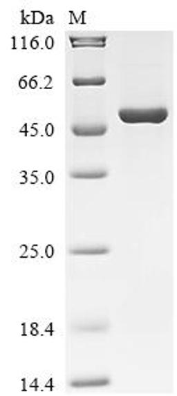 (Tris-Glycine gel) Discontinuous SDS-PAGE (reduced) with 5% enrichment gel and 15% separation gel.