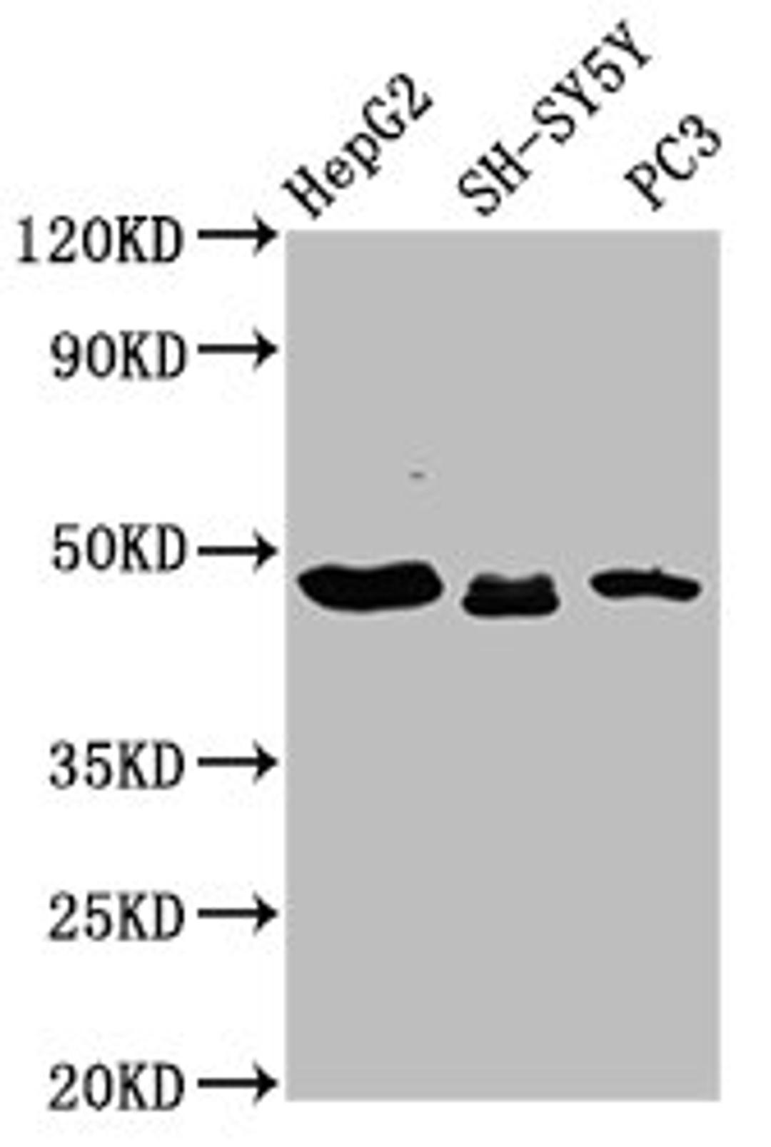 Western Blot. Positive WB detected in: HepG2 whole cell lysate, SH-SY5Y whole cell lysate, PC-3 whole cell lysate. All lanes: CXorf36 antibody at 3.9µg/ml. Secondary. Goat polyclonal to rabbit IgG at 1/50000 dilution. Predicted band size: 49, 21 kDa. Observed band size: 49 kDa