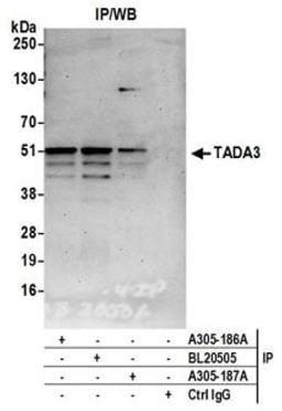 Detection of human TADA3 by western blot of immunoprecipitates.