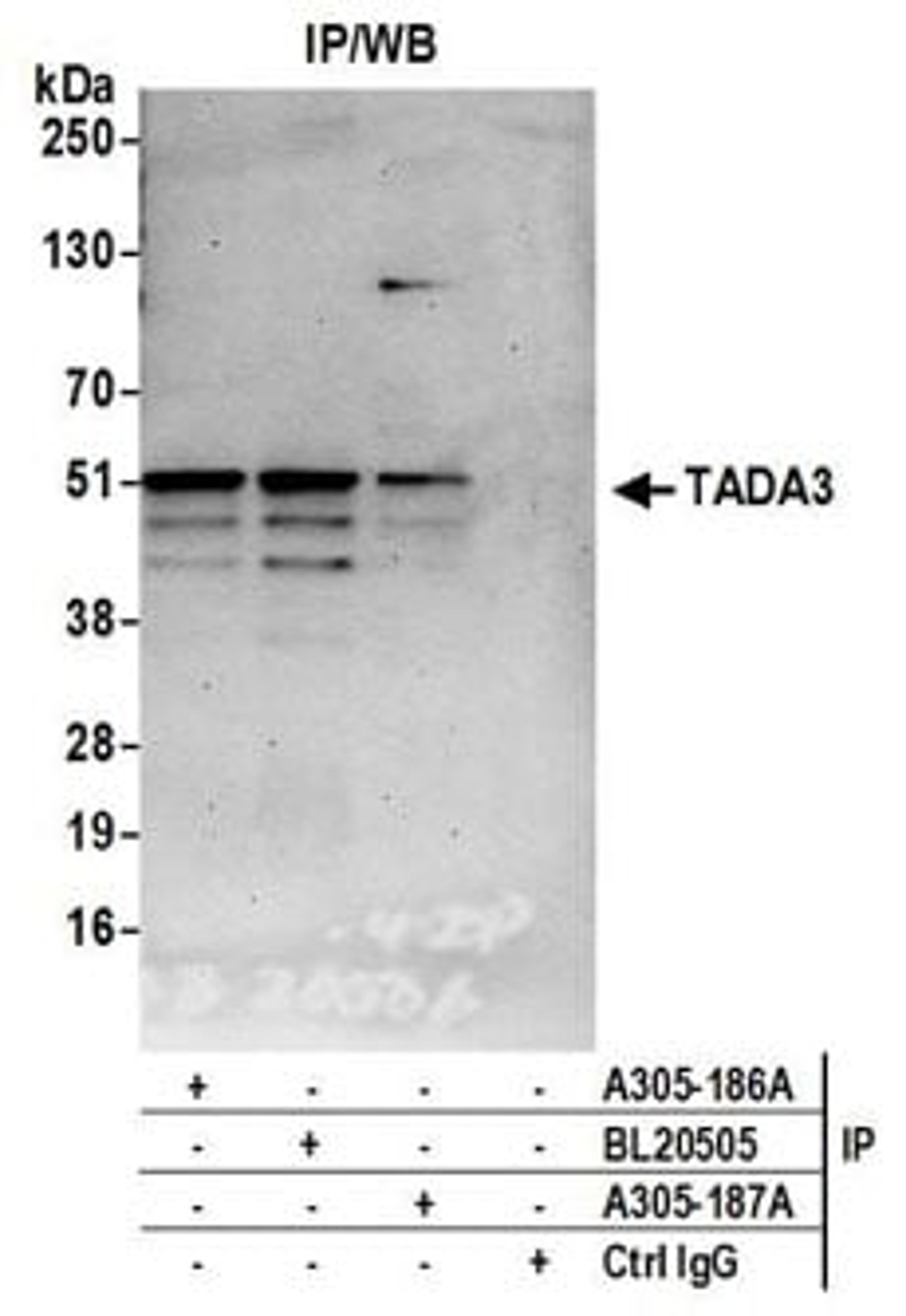 Detection of human TADA3 by western blot of immunoprecipitates.