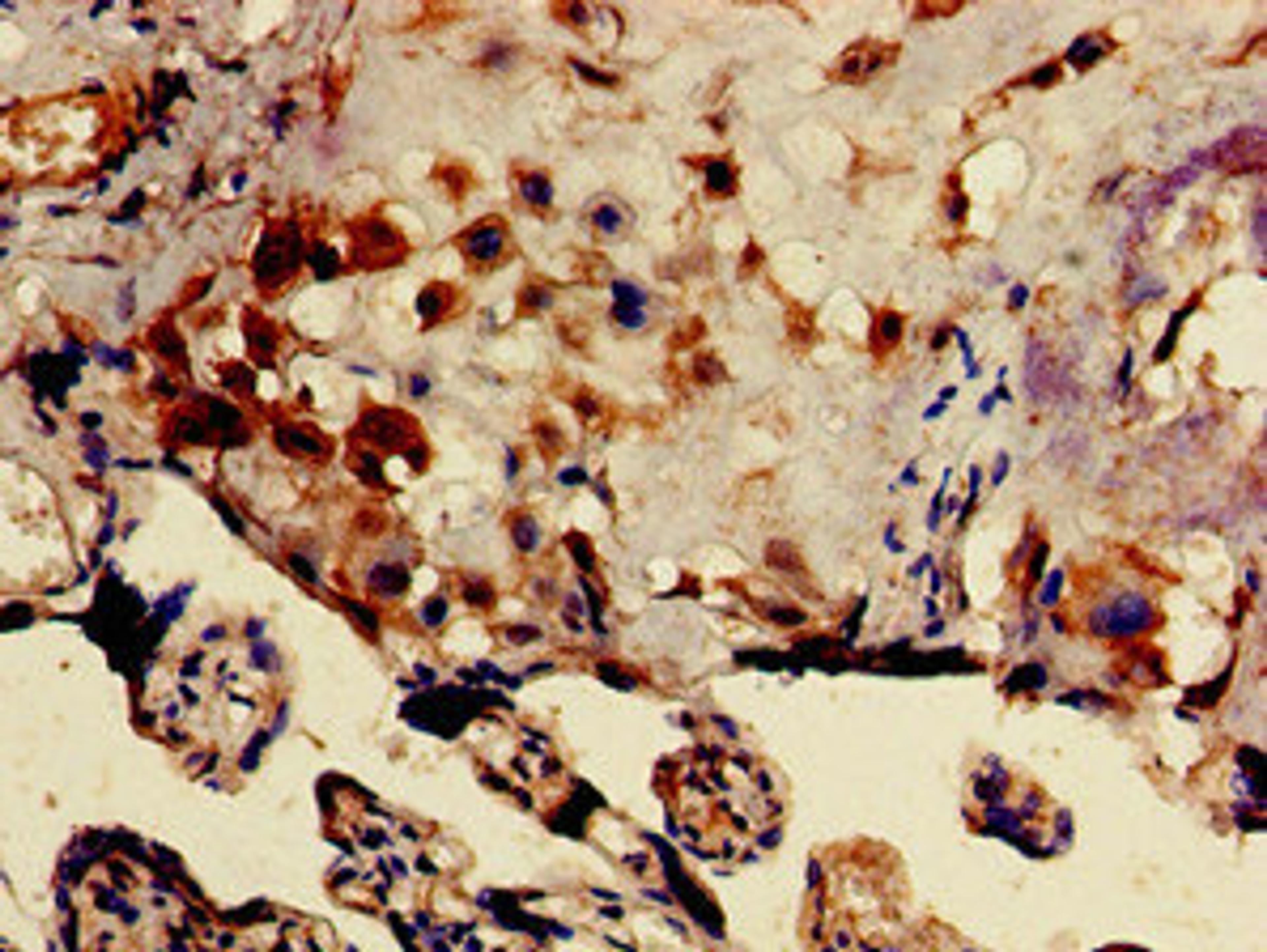 Immunohistochemistry of paraffin-embedded human placenta tissue using CSB-PA897524LA01HU at dilution of 1:100