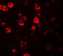 Immunocytochemistry/Immunofluorescence: CXXC4 Antibody [NBP1-76491] - Immunofluorescence of CXXC4 in human brain tissue with CXXC4 antibody at 20 ug/mL.