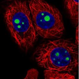 Immunocytochemistry/Immunofluorescence: FTSJ2 Antibody [NBP2-30894] - Immunofluorescent staining of human cell line MCF-7 shows positivity in nucleoli. Antibody staining is shown in green.