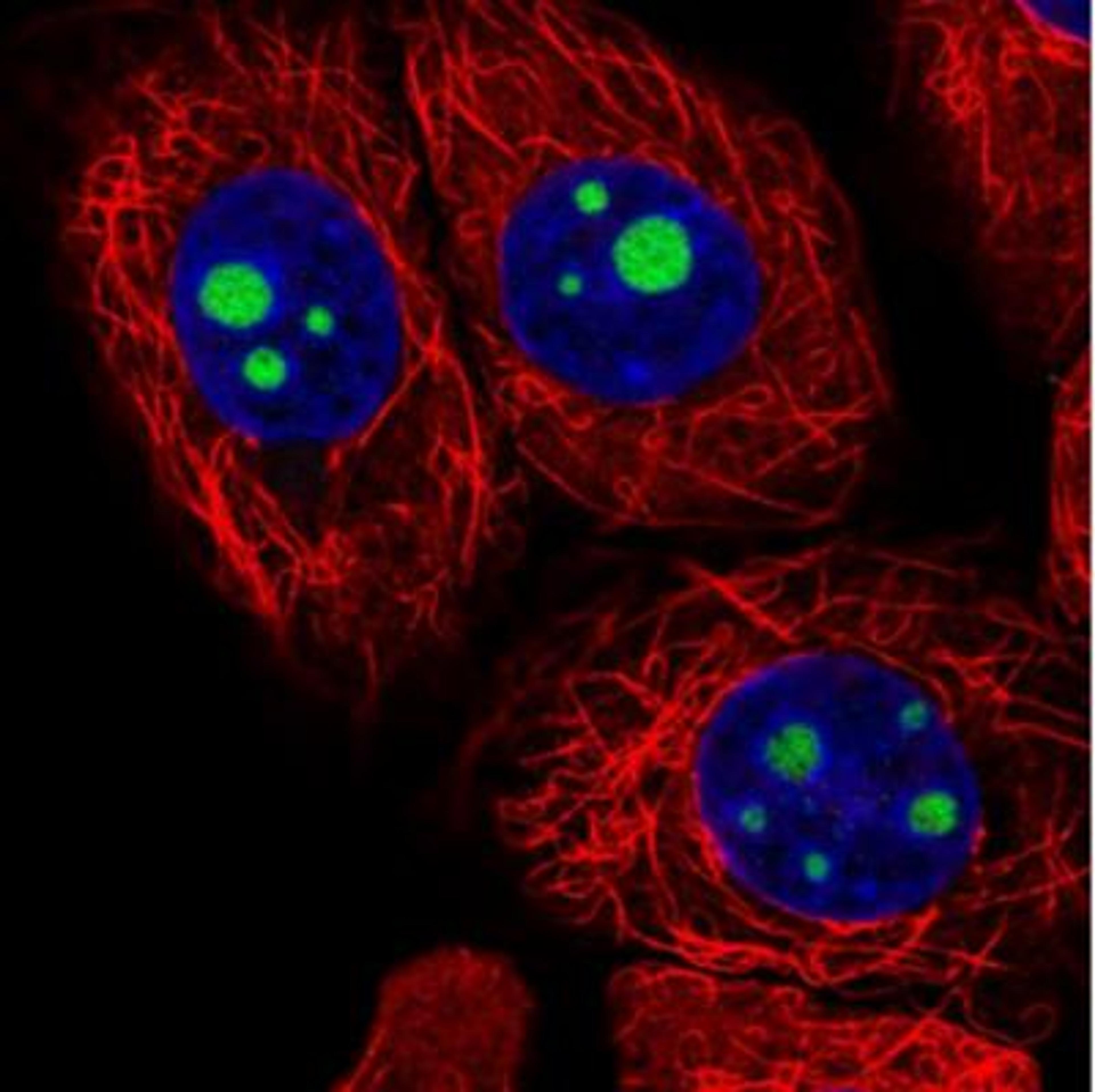 Immunocytochemistry/Immunofluorescence: FTSJ2 Antibody [NBP2-30894] - Immunofluorescent staining of human cell line MCF-7 shows positivity in nucleoli. Antibody staining is shown in green.