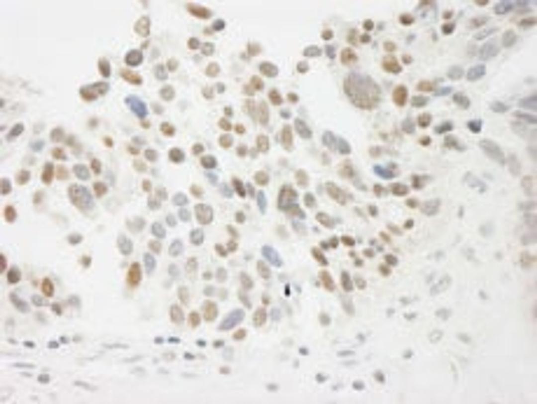 Detection of human THOC5 by immunohistochemistry.