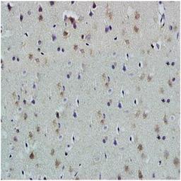 Paraffin-embedded rat brain tissue fixed with 4% paraformaldehyde. Antigen retrieval by boiling with citrate buffer. Blocking buffer is goat serum (37 degrees for 20 min.). PLAUR/uPAR antibody at 1:200 dilution with overnight incubation at 4 degrees