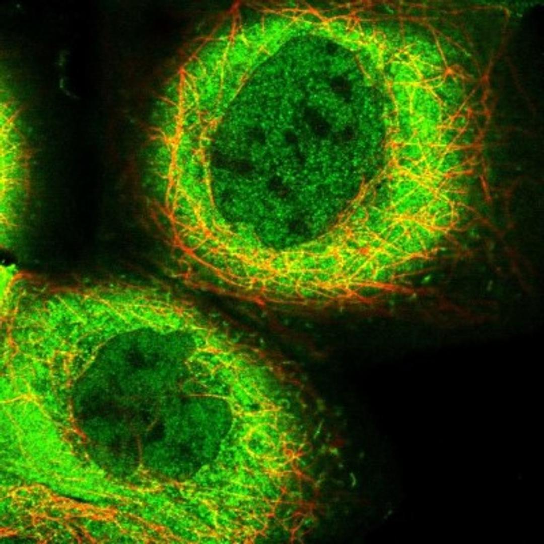 Immunocytochemistry/Immunofluorescence: C10orf90 Antibody [NBP1-90793] - Staining of human cell line A-431 shows positivity in nucleus but not nucleoli, plasma membrane & cytoplasm.