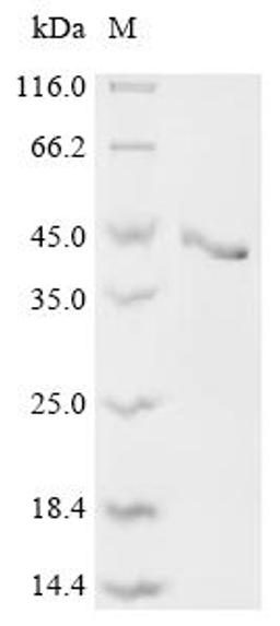 (Tris-Glycine gel) Discontinuous SDS-PAGE (reduced) with 5% enrichment gel and 15% separation gel.