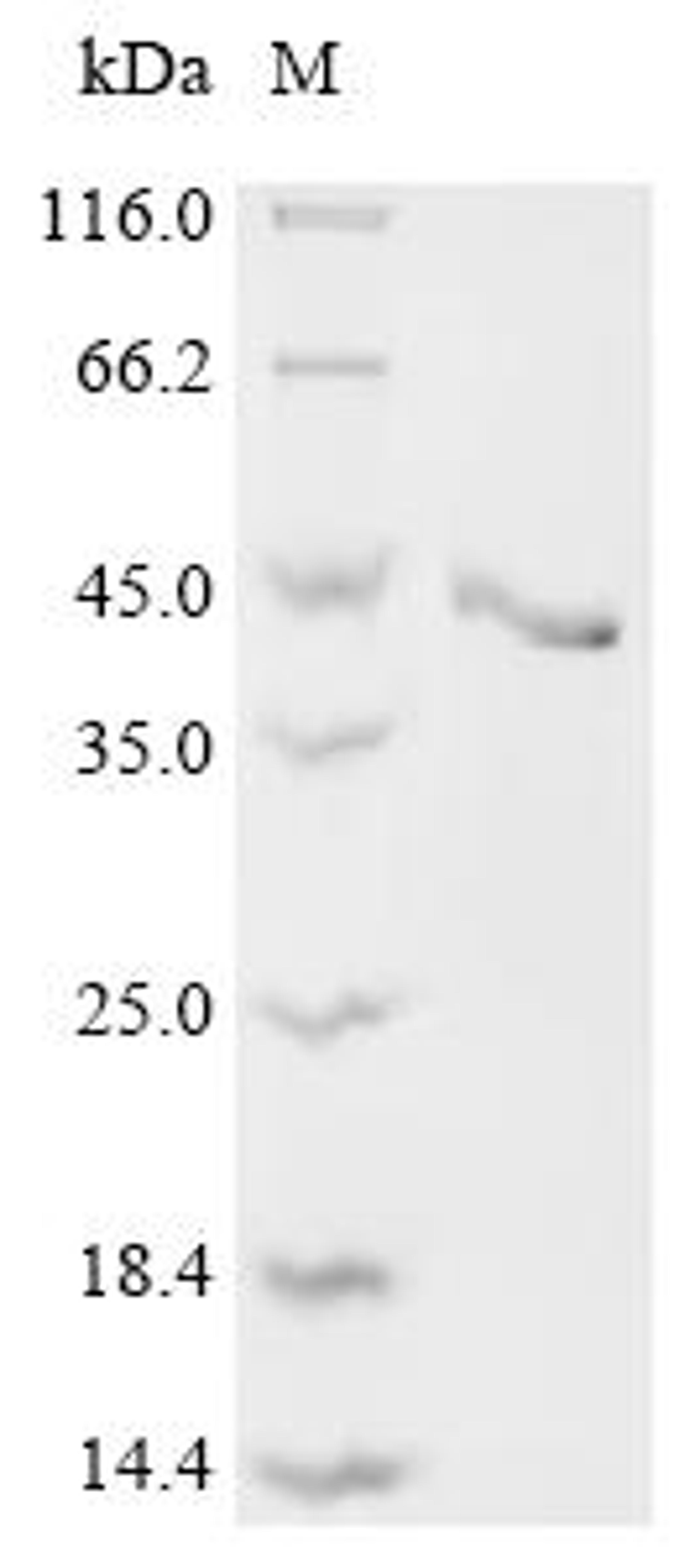 (Tris-Glycine gel) Discontinuous SDS-PAGE (reduced) with 5% enrichment gel and 15% separation gel.