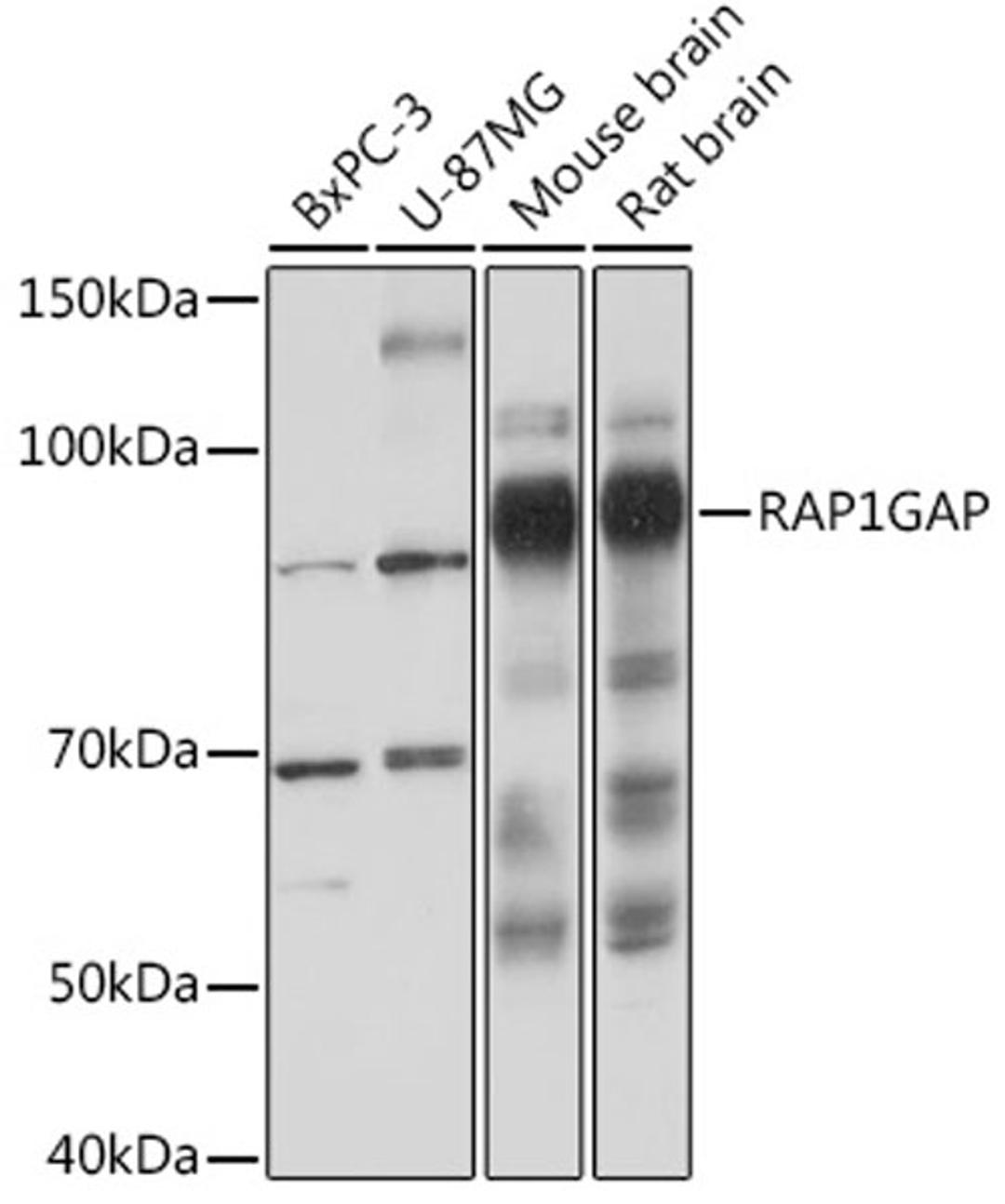 Western blot - RAP1GAP Rabbit mAb (A3621)