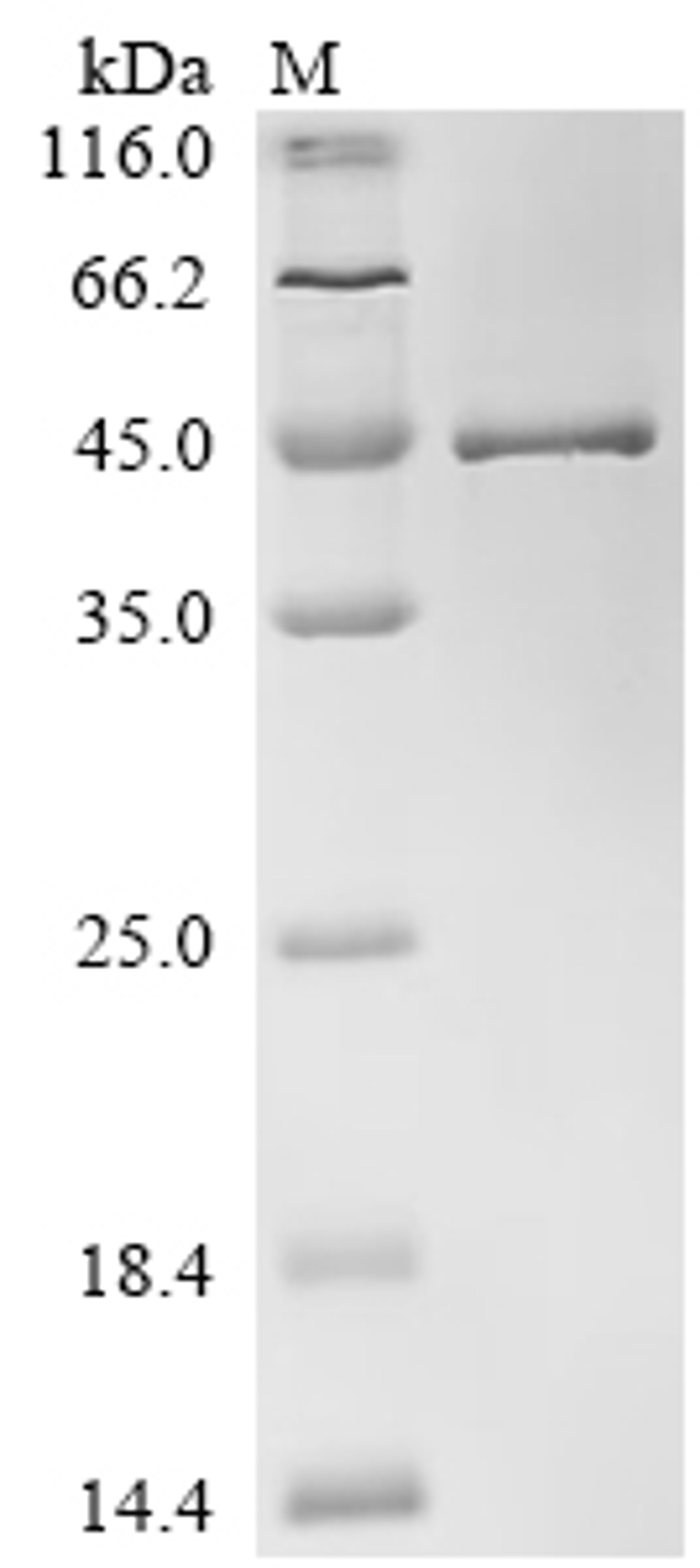 (Tris-Glycine gel) Discontinuous SDS-PAGE (reduced) with 5% enrichment gel and 15% separation gel.