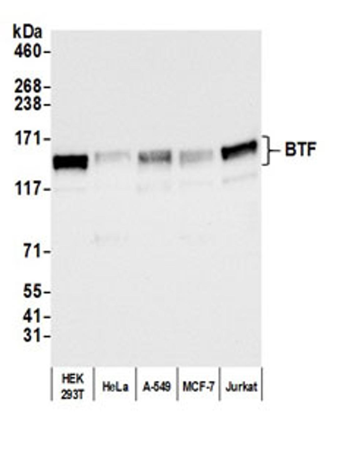 Detection of human BTF by western blot.