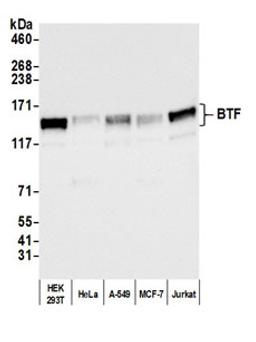 Detection of human BTF by western blot.