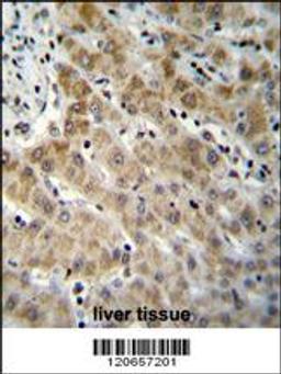 EDN1 Antibody immunohistochemistry analysis in formalin fixed and paraffin embedded human liver tissue followed by peroxidase conjugation of the secondary antibody and DAB staining.