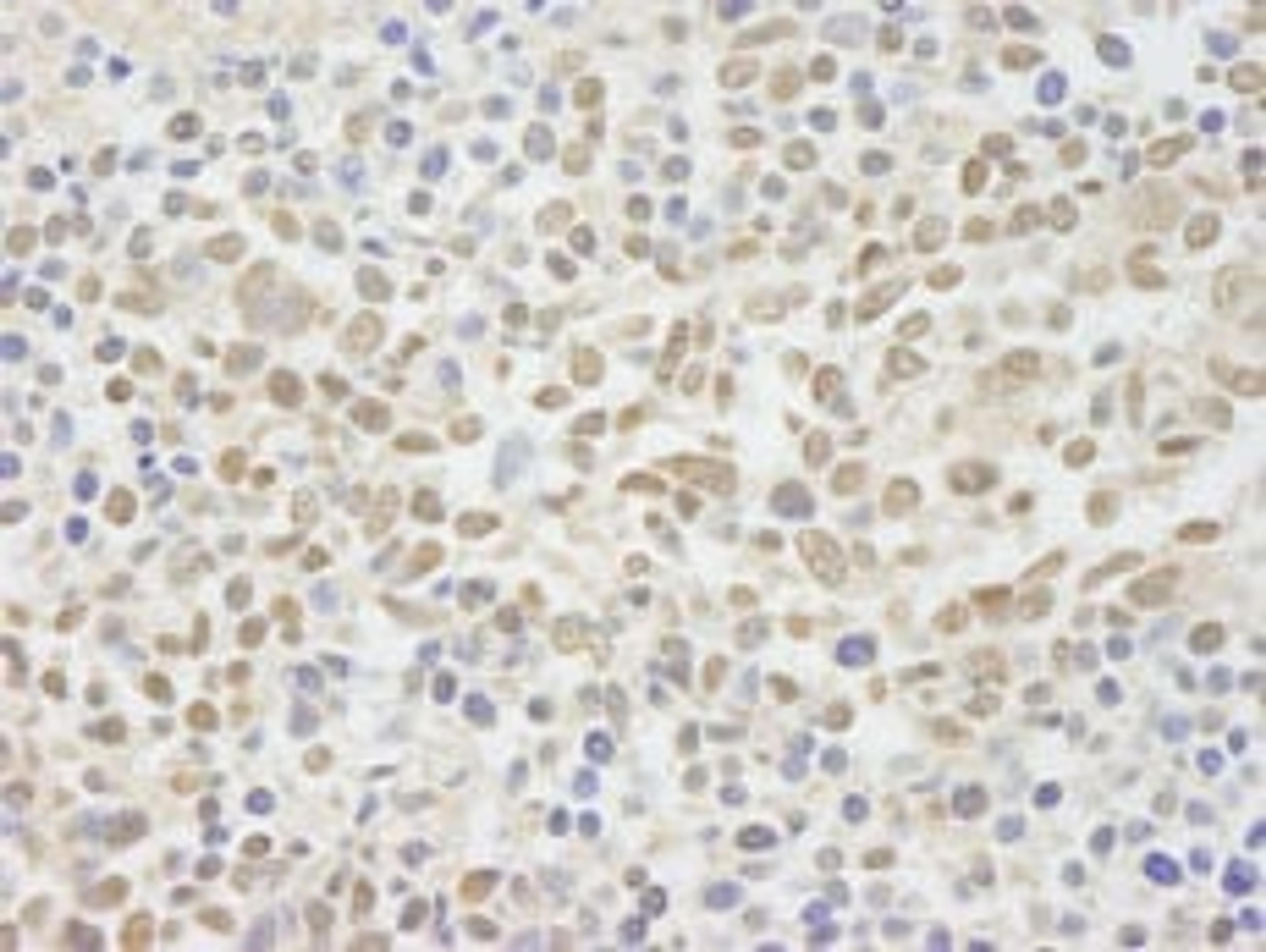 Detection of human NIF1 by immunohistochemistry.