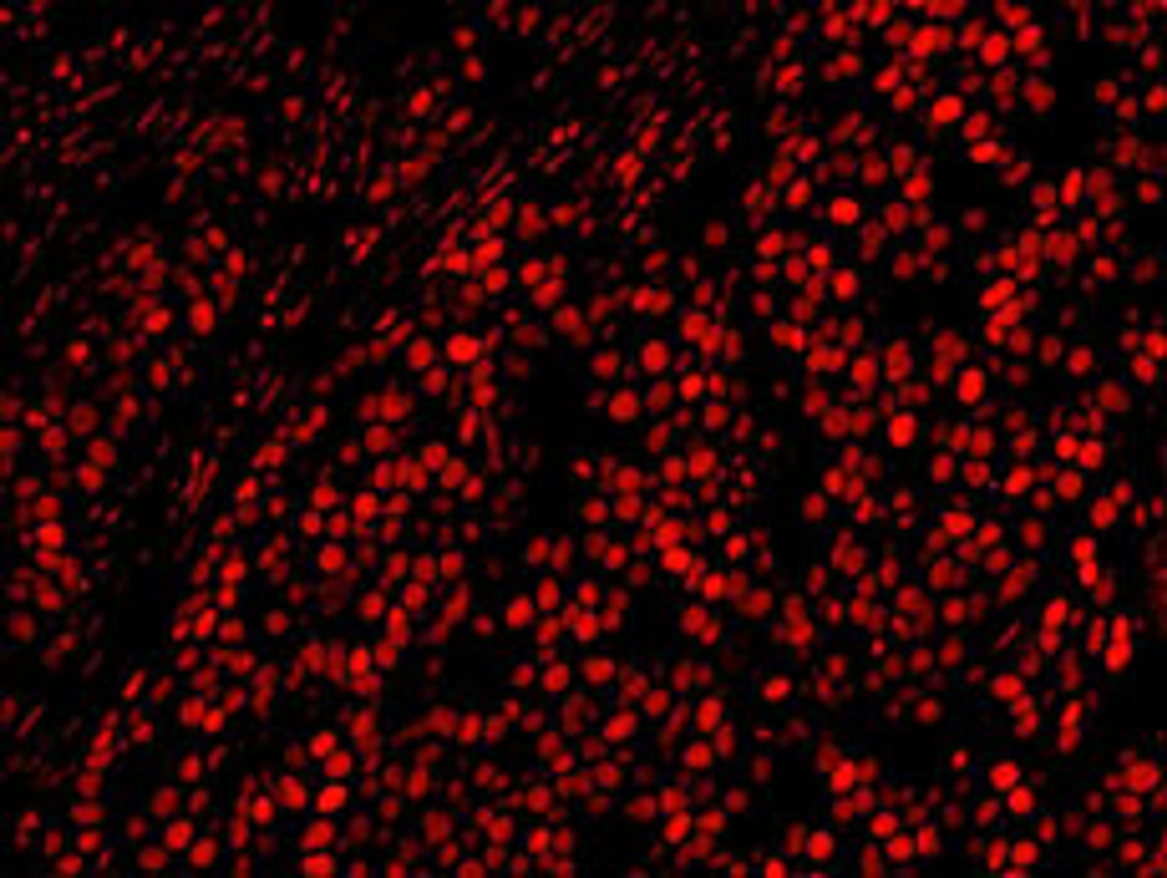 Detection of human AKAP8L/HA95 by immunohistochemistry.